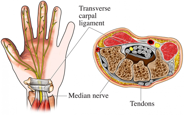 Carpal Tunnel Ultrasound and Injection - Amara Pain & Spine Management