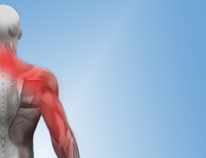 Neck pain and Arm pain