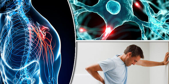 Multiple Sclerosis/ Esclerosis multiple