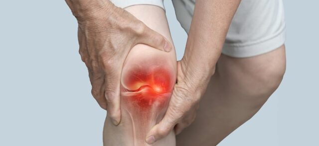 Arthritis