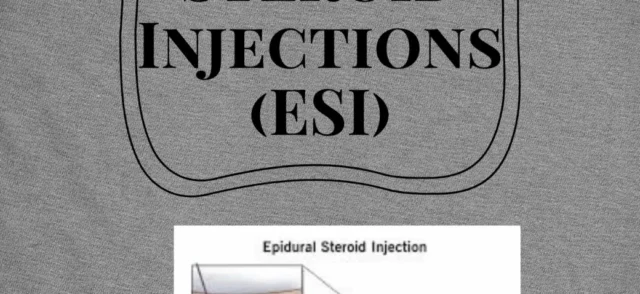 What Are Epidural Steroid Injections?